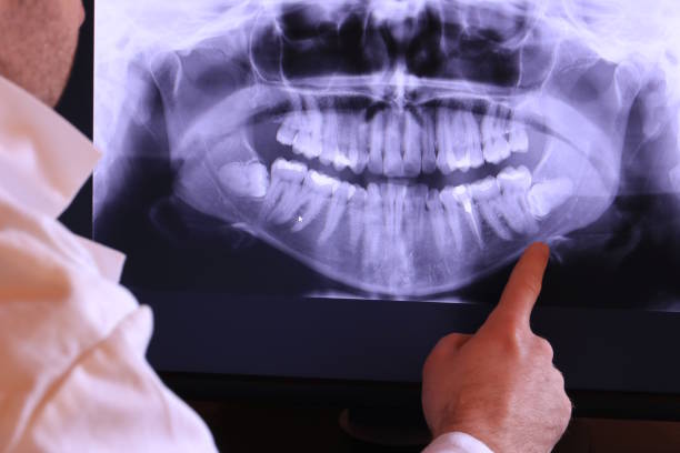 Best Dentist for Tooth Abscess  in Salem, MO