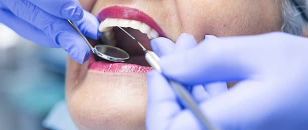 Best Urgent Tooth Repair  in Salem, MO